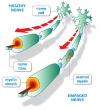 MyelinGraphic